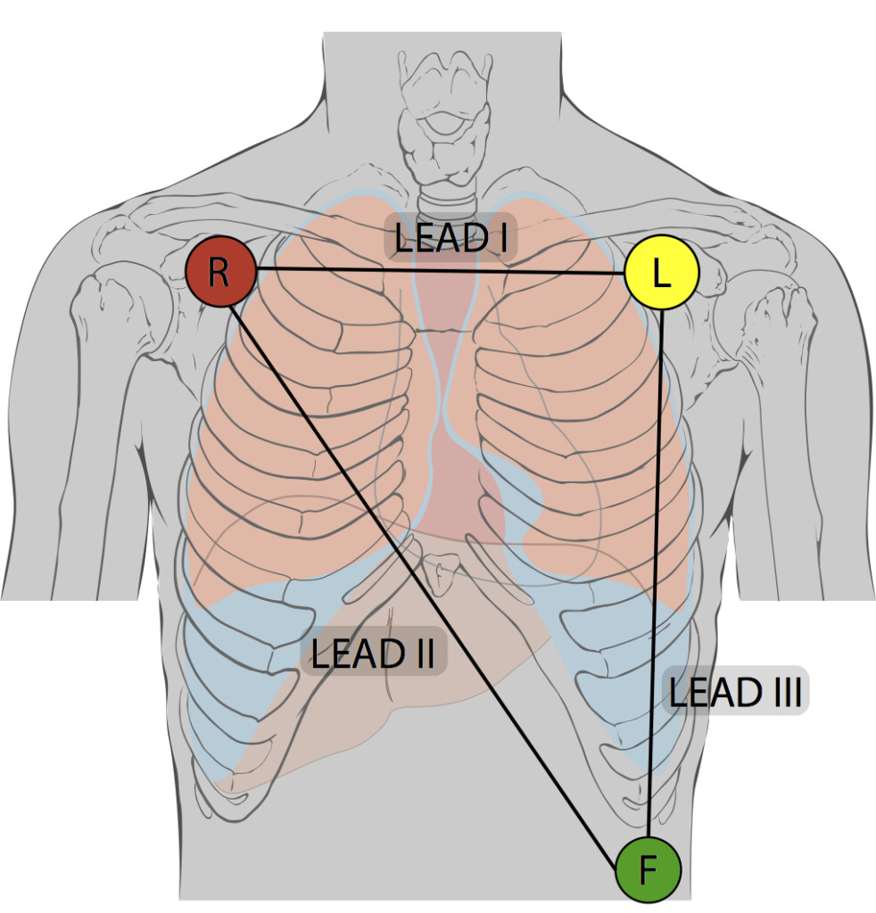 UAM Service Note #24: Using the Patient Monitor's ECG Cable with 3 Lead ...