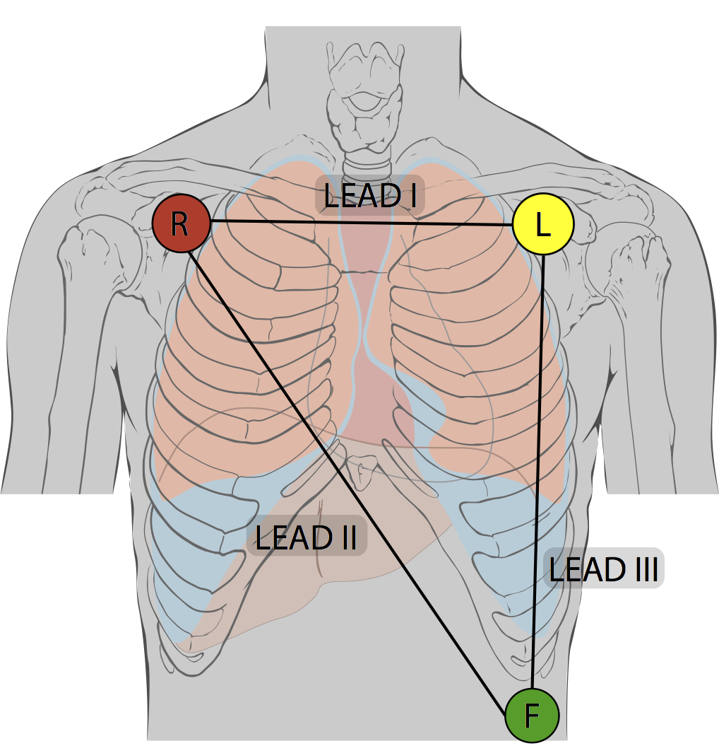 The gallery for --> Cardiac Monitor Lead Placement